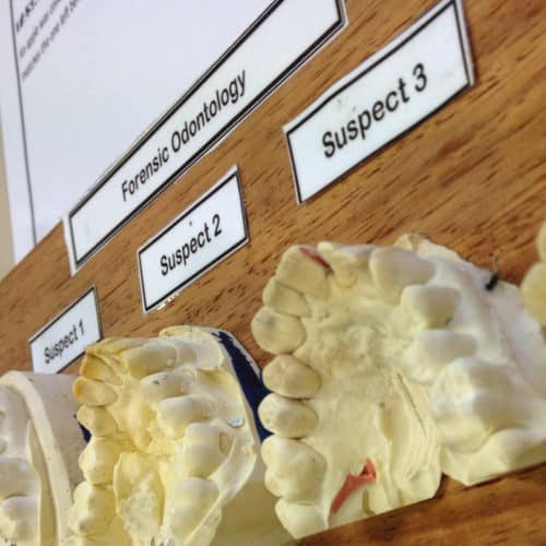 Teeth models used for forensics