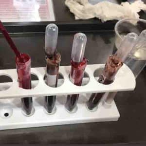 test tubes with fake blood and pipettes in them